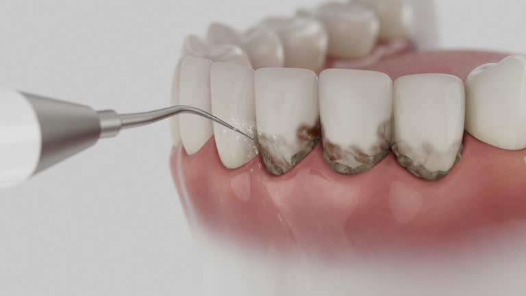 Reliable Dental contractor in Herald, CA by Smile Center Dentistry